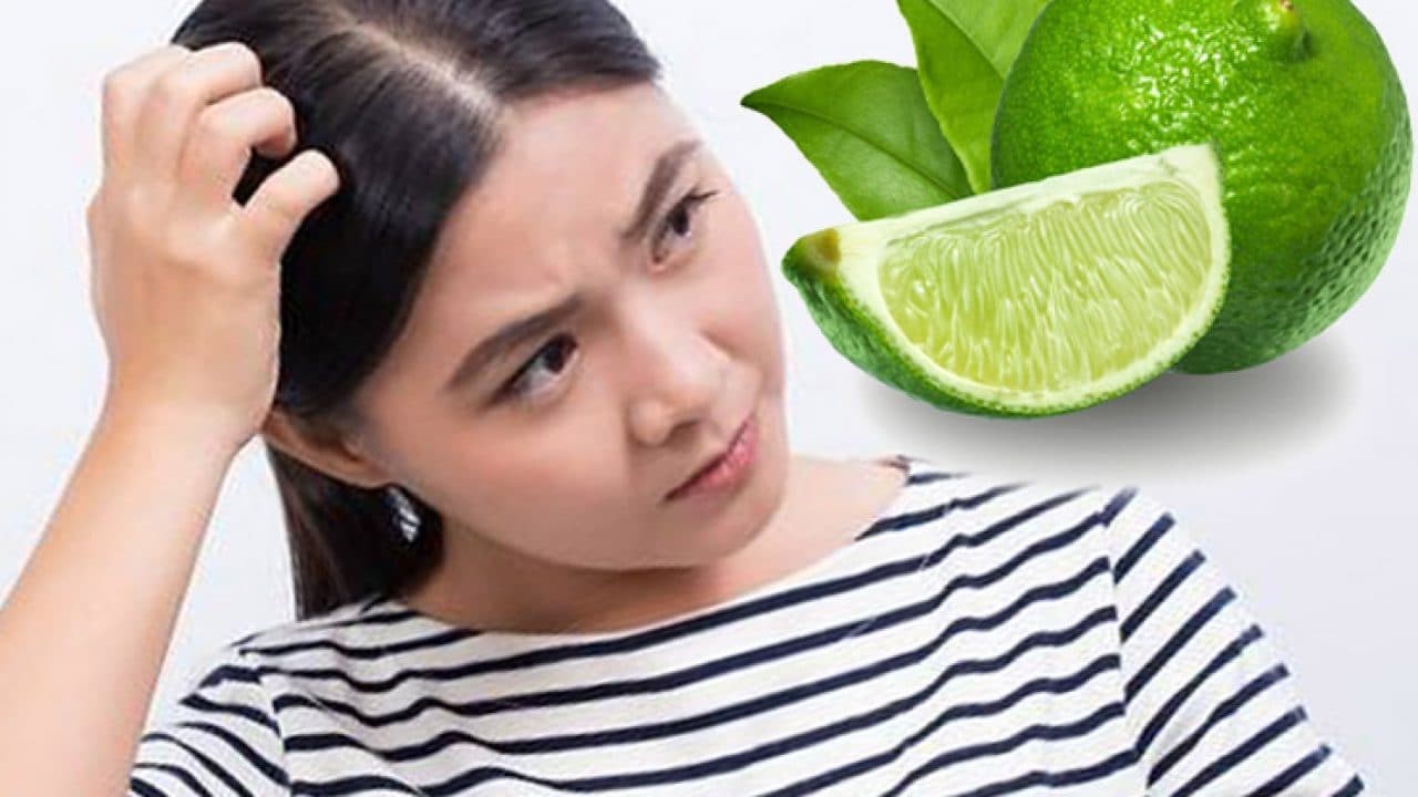 Jeruk Nipis untuk ketombe